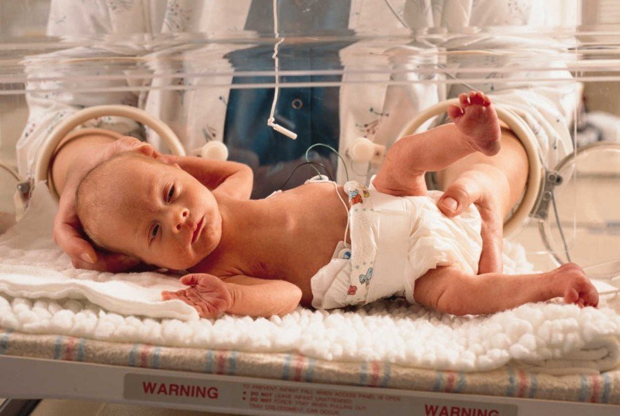 bebes prematuros en incubadora