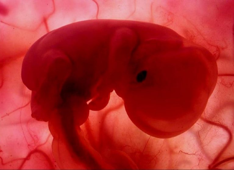 ley de aborto