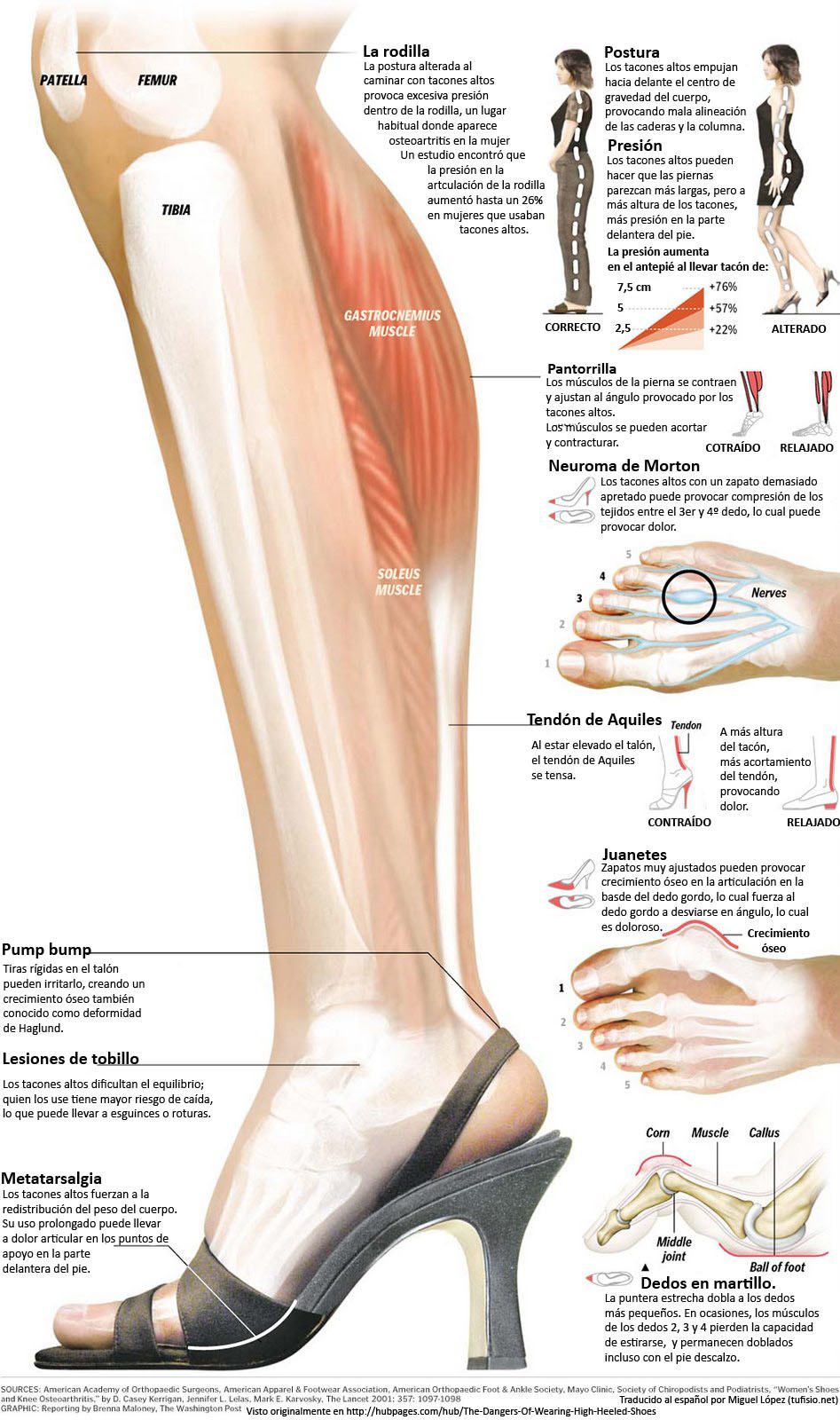 complicaciones por usar tacones altos